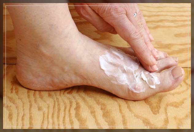 Fungal Skin Infection 18