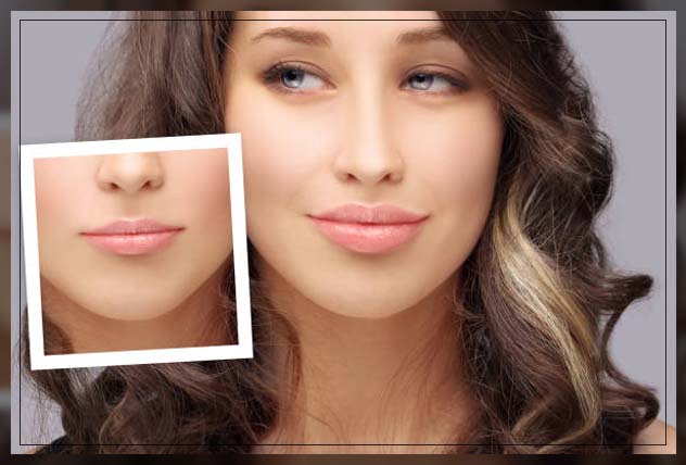 Lip Fillers Dubai 15