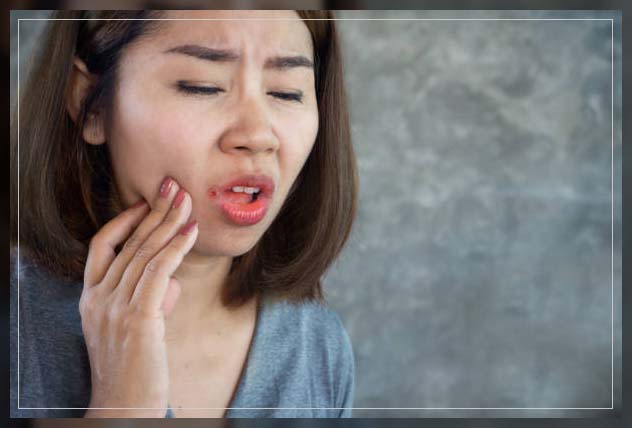 mouth sores due to dry mouth