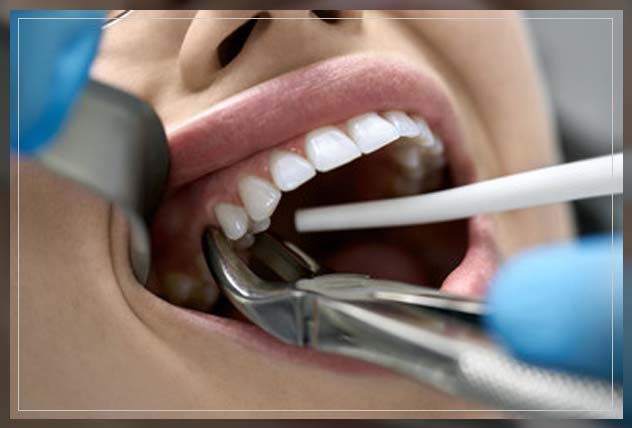 looking into how dry socket works