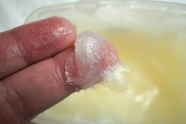 is petroleum jelly bad