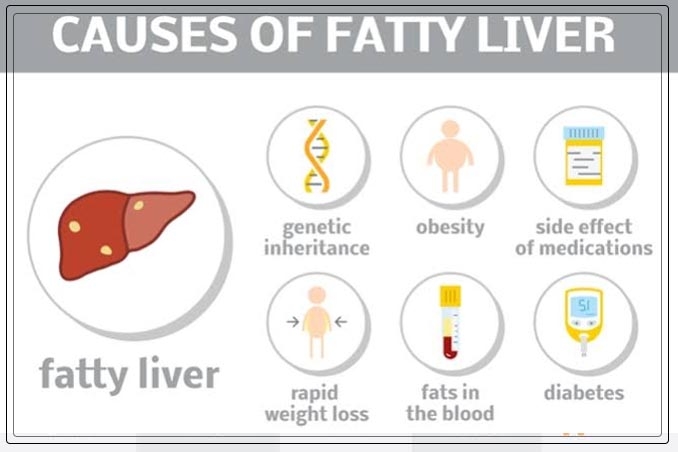 causes of fatty liver