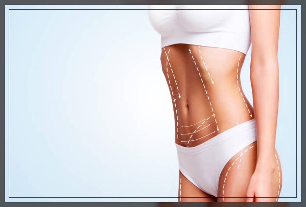 female getting liposuction in dubai