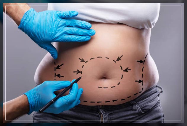 procedure side effects