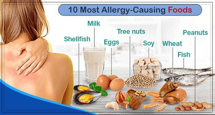 8 common food allergies