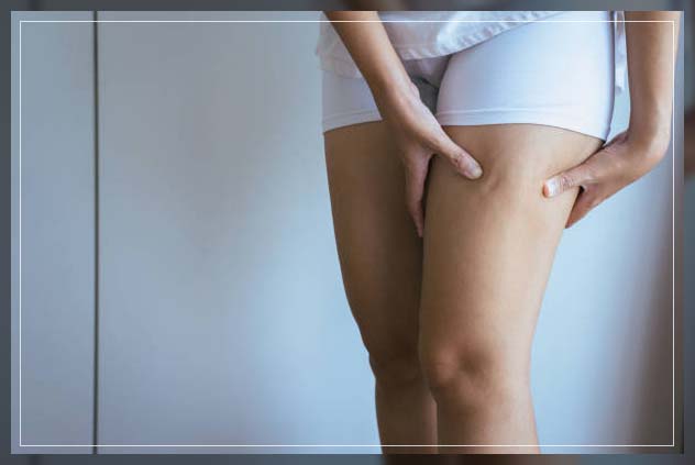 Cellulite treatment 4