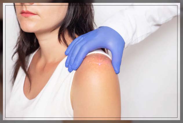 Skin Discoloration 2