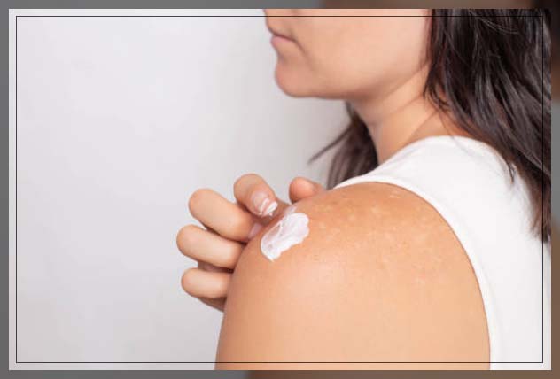 Skin Discoloration 7