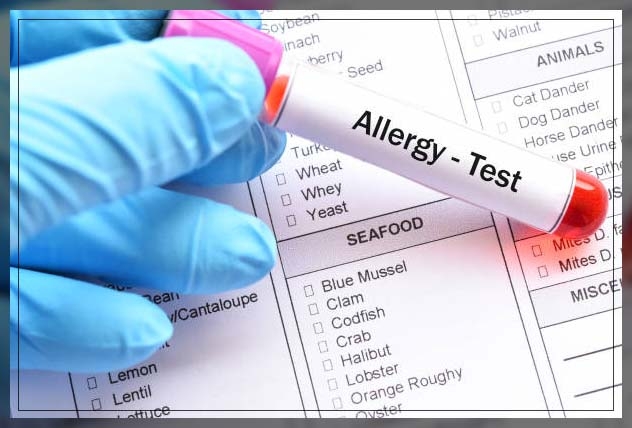 allergy test