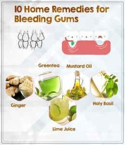adapt various remedies for bleeding gums control