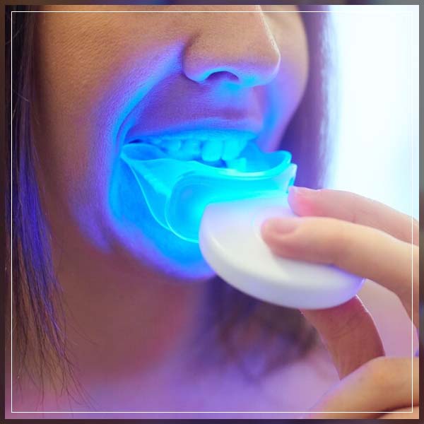 choosing teeth-whitening-kit