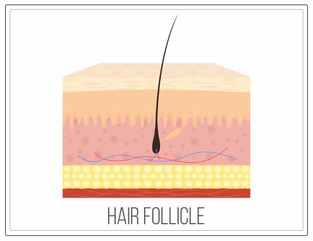 Perifollicular Scale: A Clue to the Diagnosis of Lichen Planopilaris —  Donovan Hair Clinic