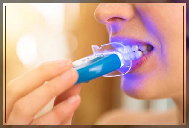 products inside teeth whitening kit