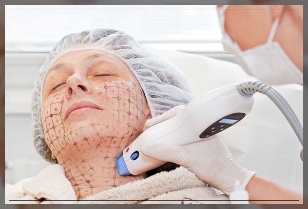 thermage dubai treatment