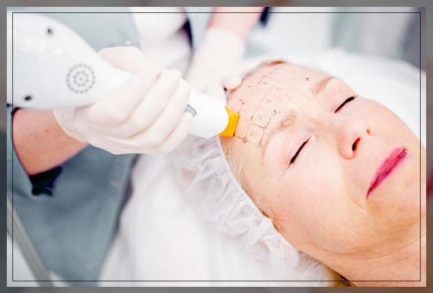 thermage-skin rejuvenation