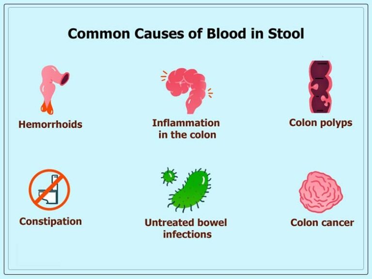 Blood in Stool: Causes, Diagnosis and Treatment - REPC