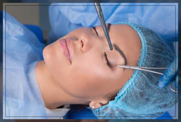 Eyelid surgery 4