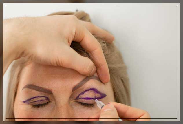 Eyelid surgery 8