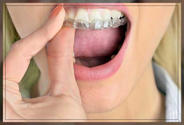 wearing mouth guard at night time