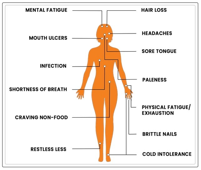 symptoms of IDA