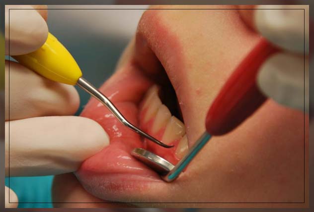 how periodontal disease makes oral health worse