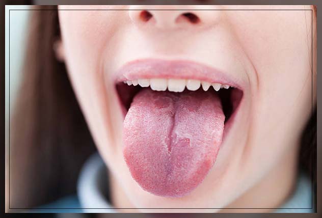 pattern appearance of lesions