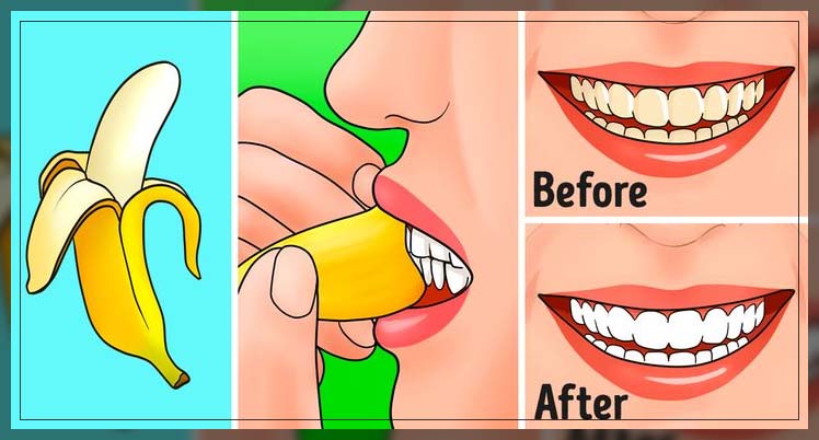 results of using banana peel