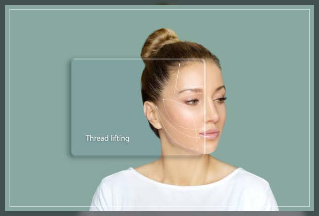 Thread Lift 1
