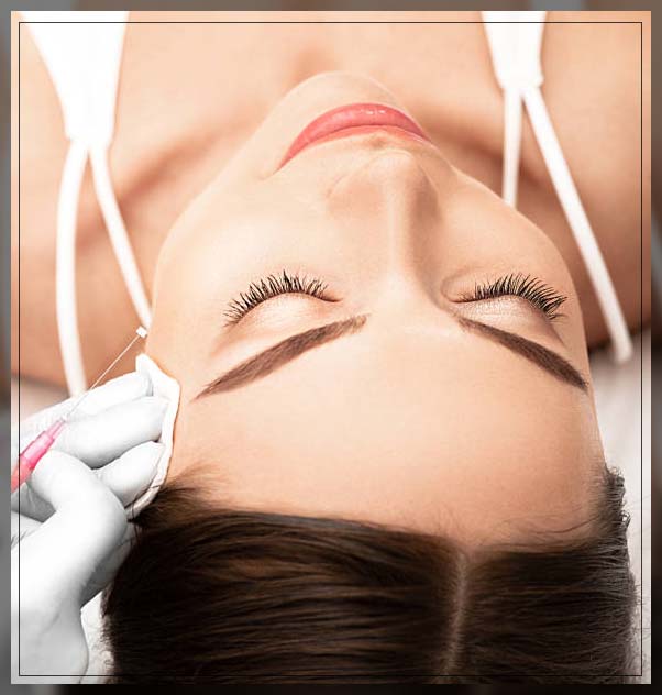 Thread Lift 2