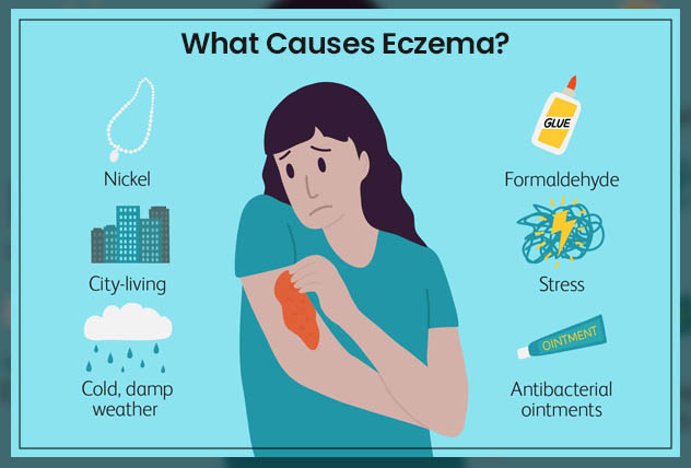 Eczema Treatment Repc
