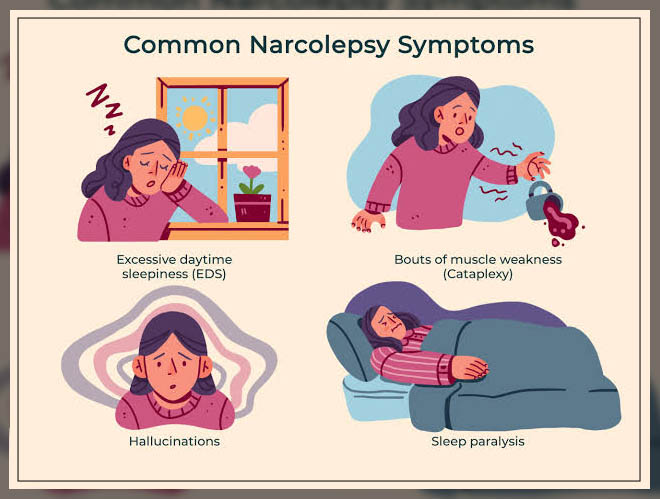 narcolepsy