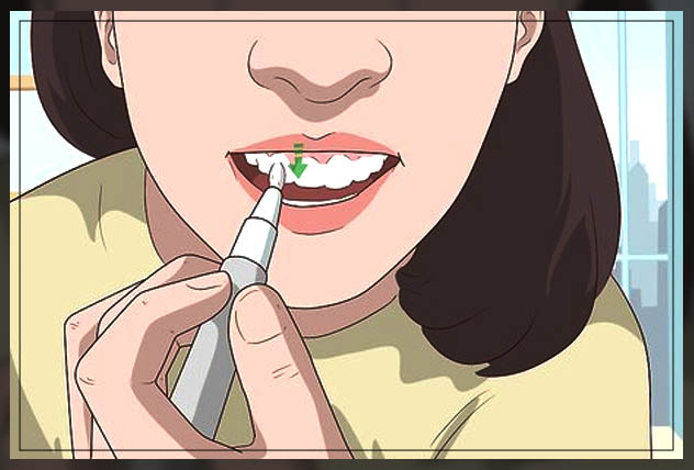 using teeth whitening pen