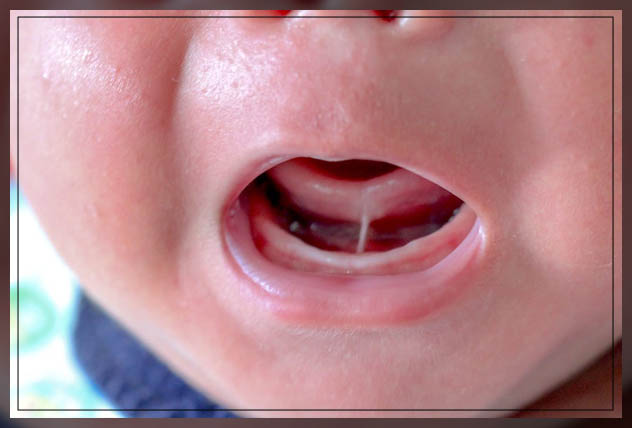 looking at the symptoms 