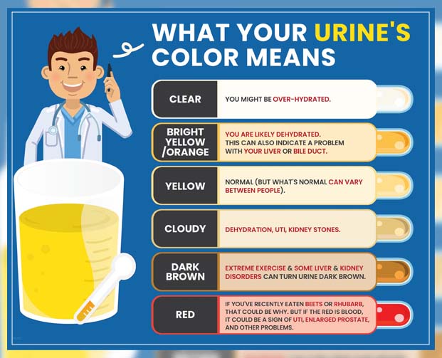 Urine Colors Explained REPC