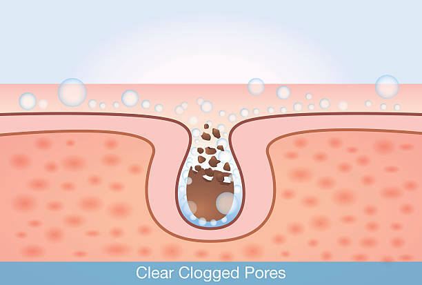 unclog pores