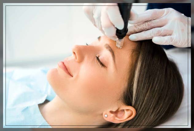 Mesotherapy before and after 2