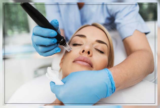 Mesotherapy before and after 4