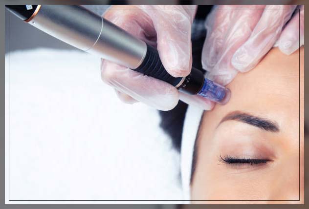 Mesotherapy before and after 5