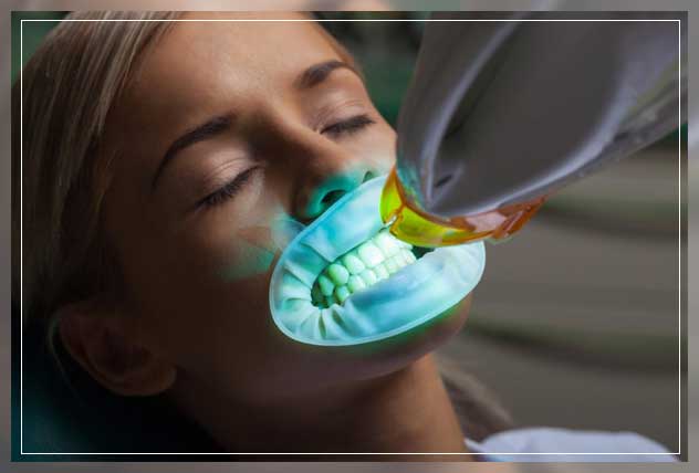 need for whitening treatments