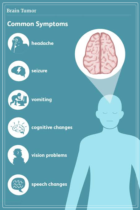 brain tumor symptoms