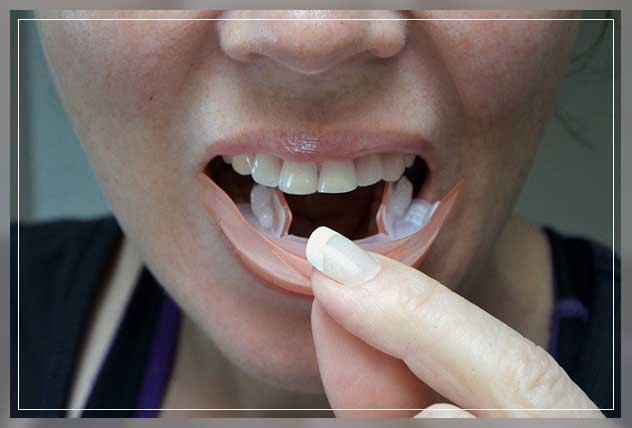 strips covering teeth