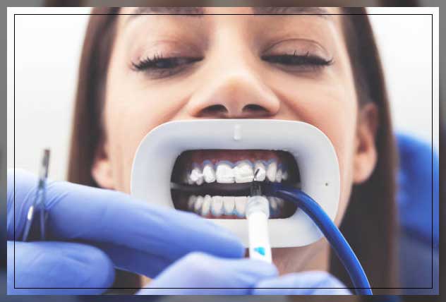 teeth whitening gel at dental clinic