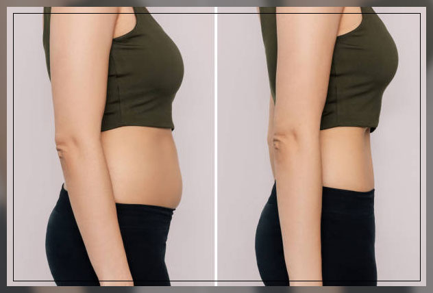 Belly fat 1