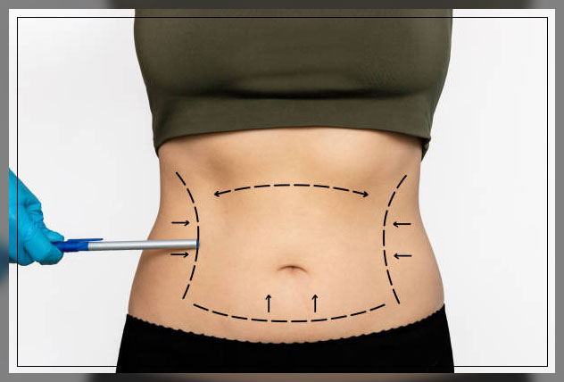Belly fat 6
