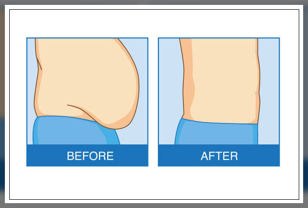 Belly fat 8