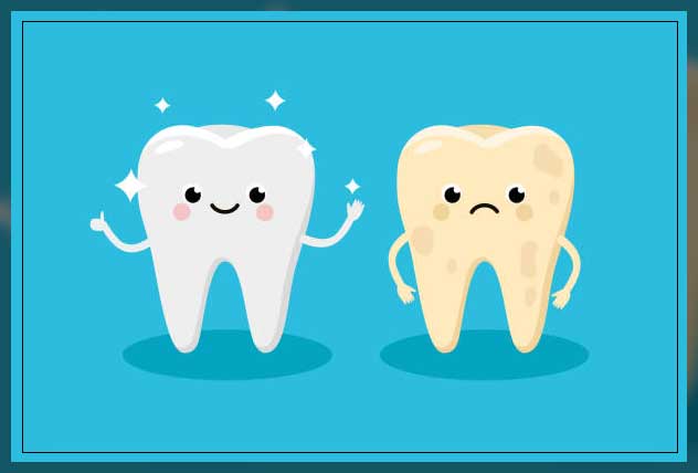 Teeth whitening Dubai 9