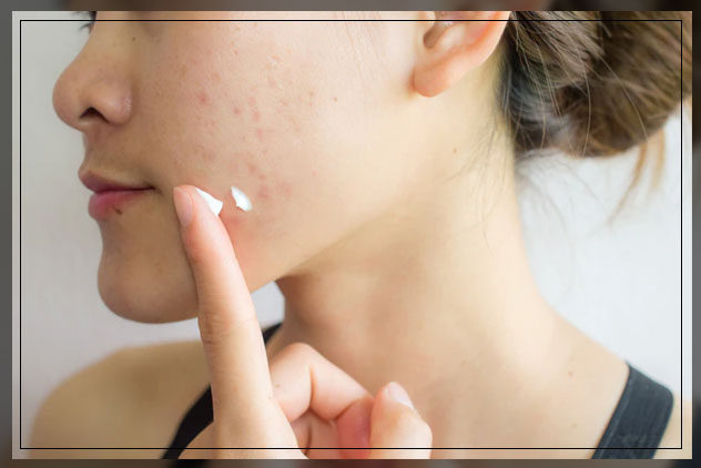 Vitamin e application