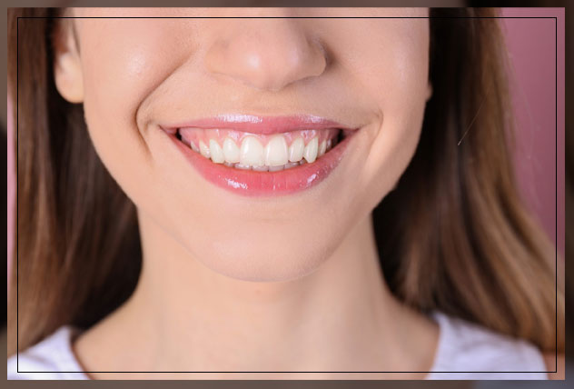 look of a gummy smile