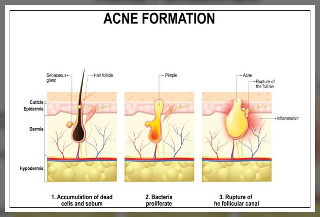 Sebaceous glands 6