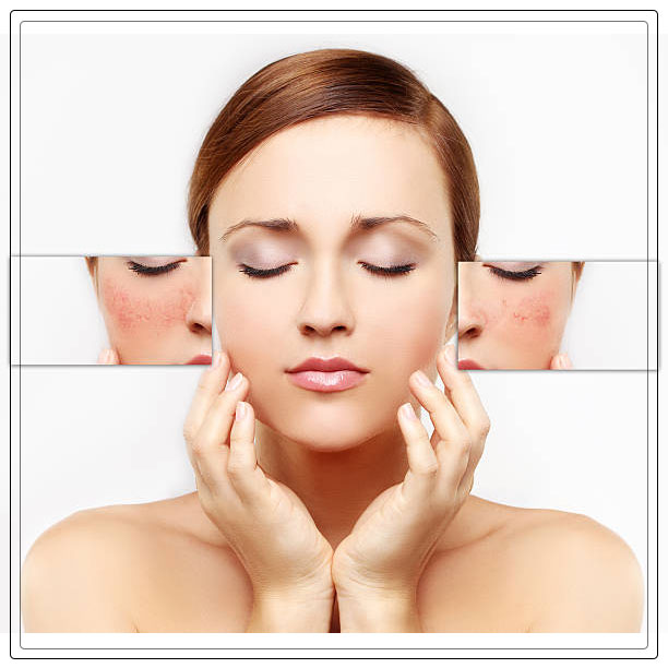Sebaceous glands 7